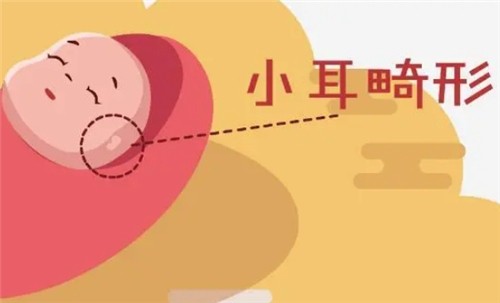 【河南中醫(yī)藥大學(xué)一附院】莊洪興教授暑假坐診，耳畸形修復(fù)限時(shí)預(yù)約！