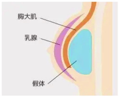米蘭柏羽開(kāi)啟胸部醫(yī)生面診日，穆大力、李英大親診做出精致自然美胸