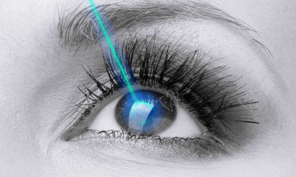 深圳普瑞眼科醫(yī)院近視手術活動